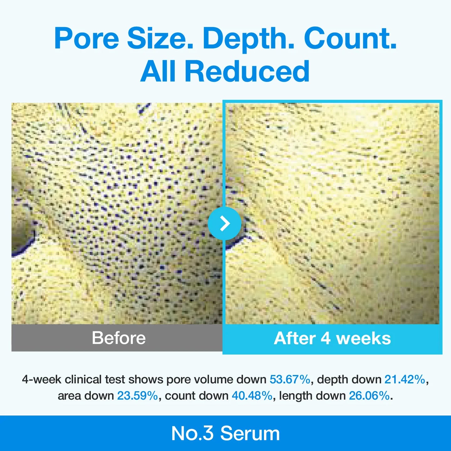 Numbuzin No. 3 Blue Bio-Retinol Pore Refining Serum