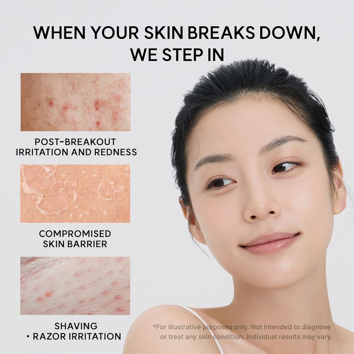 Arencia - Eraser Soothing Cream