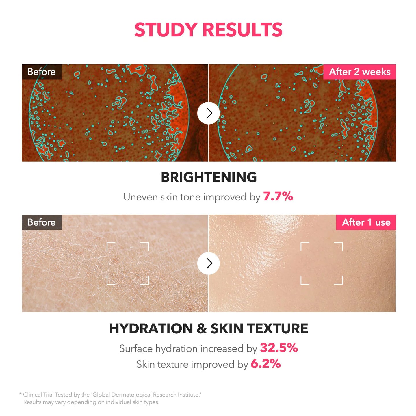 APRILSKIN - TXA Niacinamide 99 Milky Toner