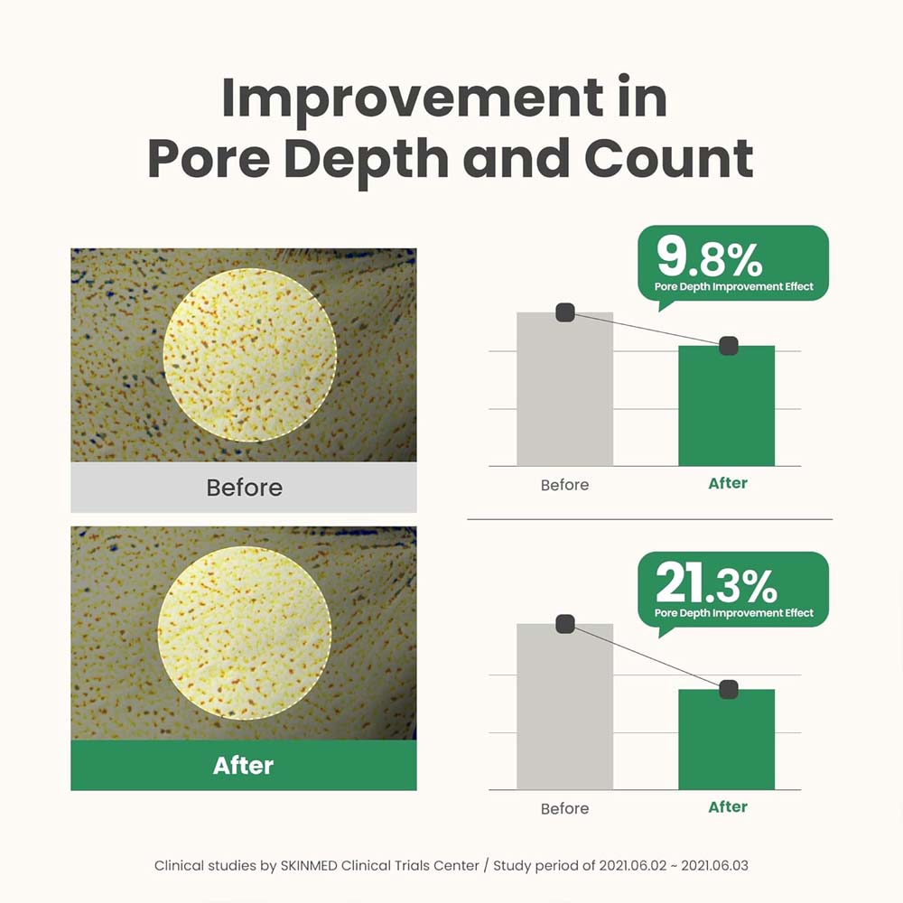 AXIS-Y Mugwort Pore Clarifying Wash Off Mask
