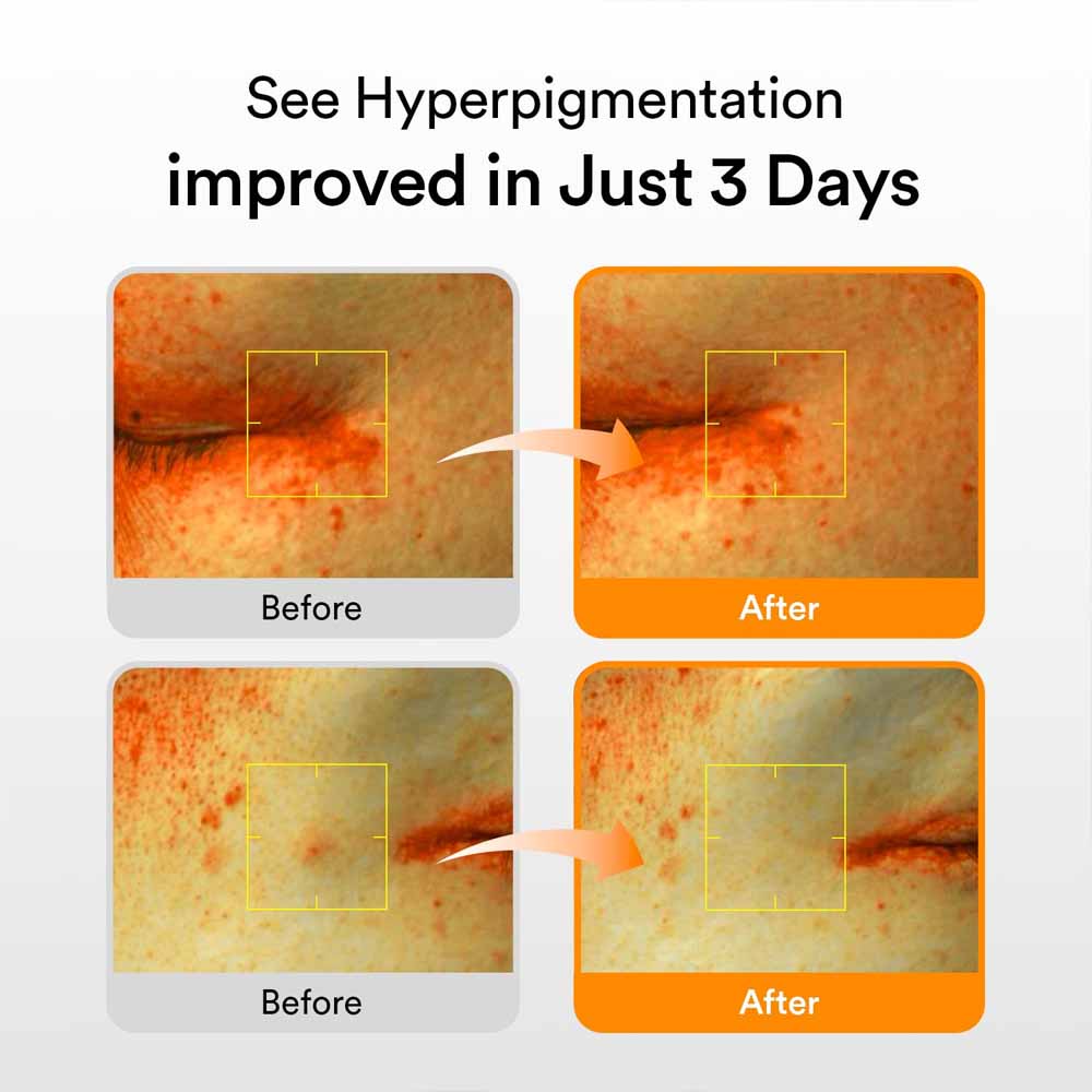 Abib Glutathiosome Dark Spot Serum Vita Drop