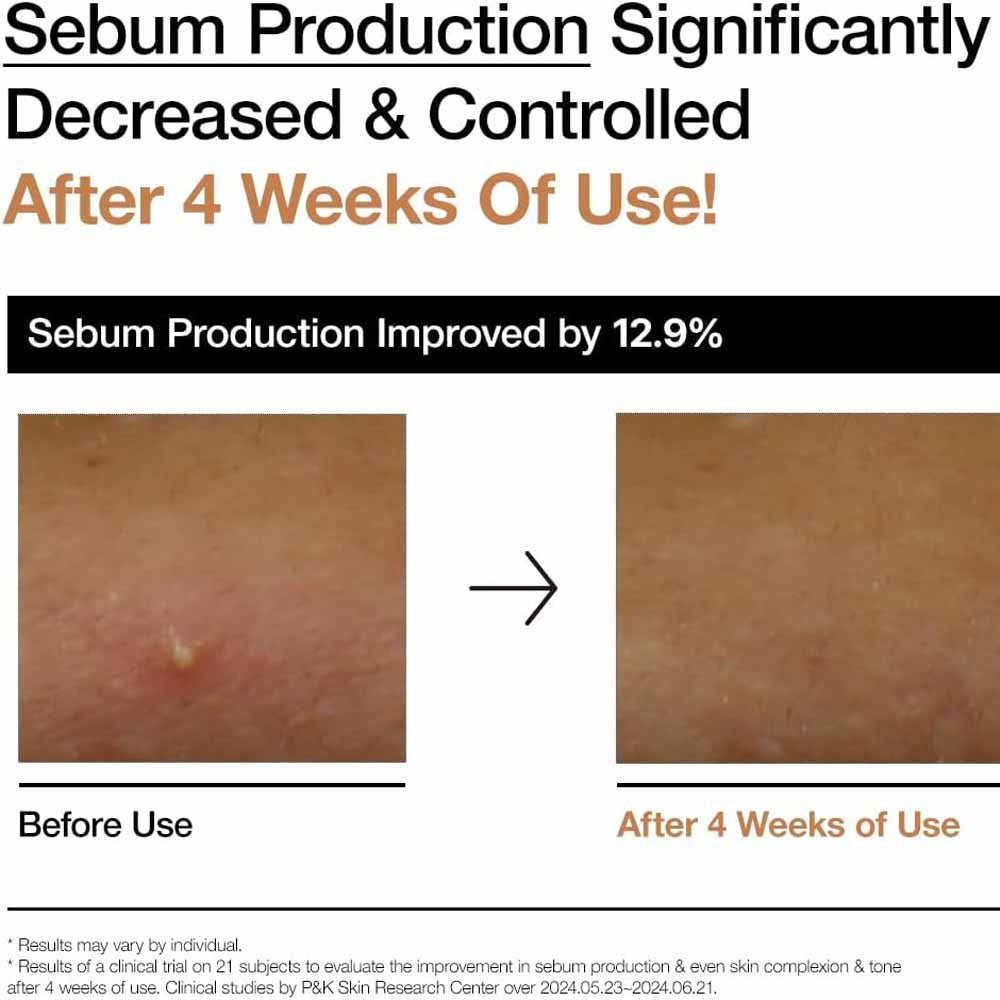 Anua Rice 70 Glow Milky Toner