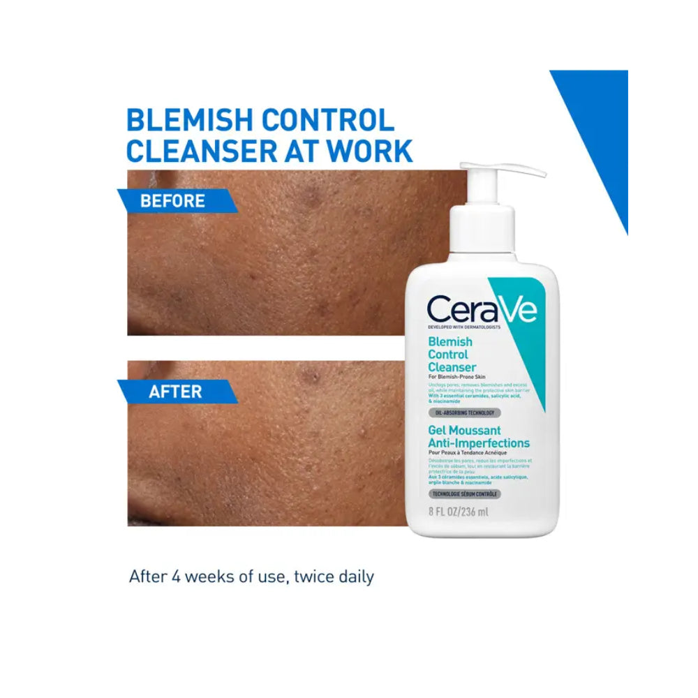 Cerave Blemish Control Cleanser for Blemish Prone Skin