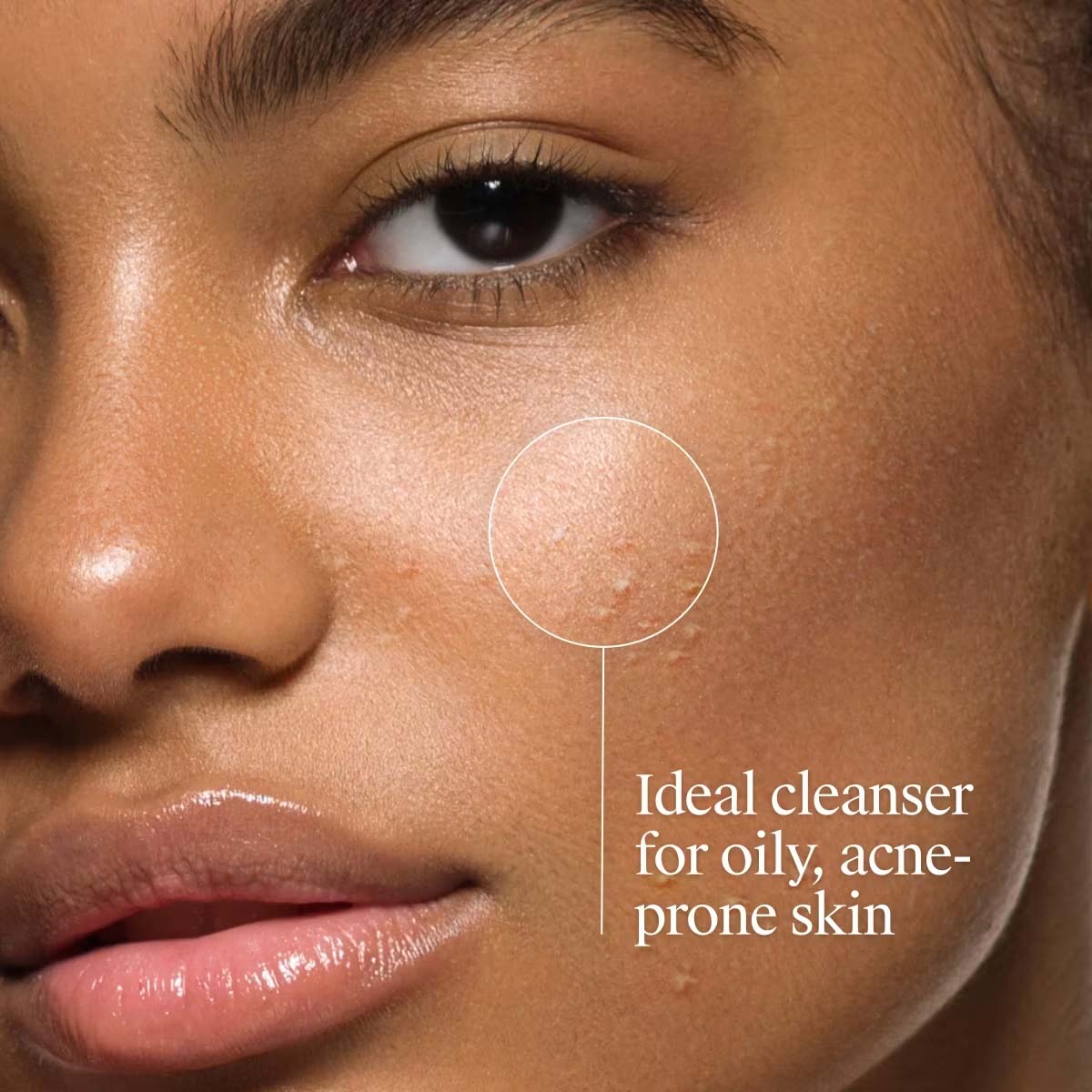 Neutrogena Oil-Free Acne Wash with 2% Salicylic Acid USA