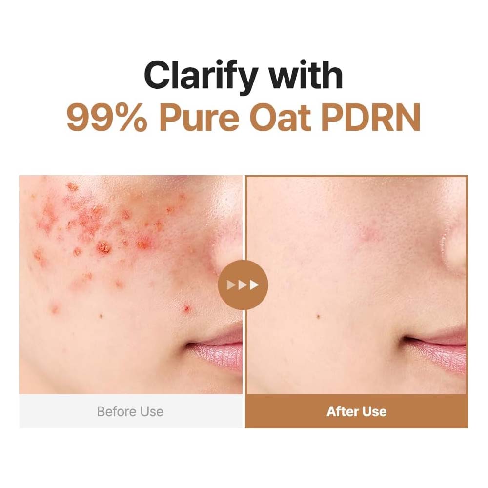 Purito SEOUL - Oat PDRN Gentle Refining Toner