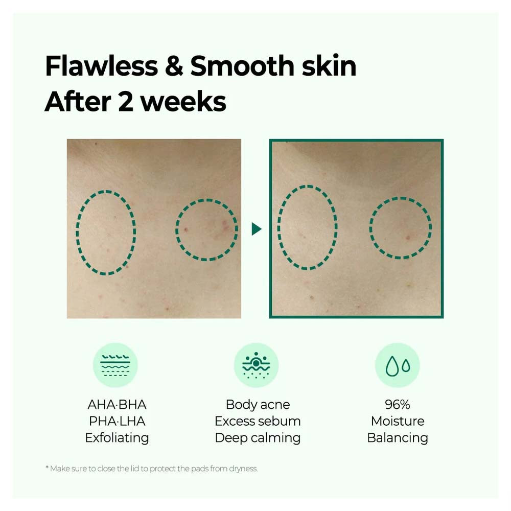 SOME BY MI AHA-BHA-PHA Miracle Calming Body Lotion