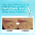 Numbuzin No. 1 Pantothenic B5 Active Soothing Serum