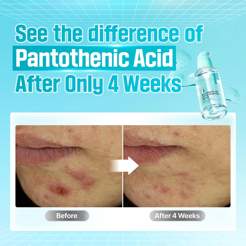 Numbuzin No. 1 Pantothenic B5 Active Soothing Serum