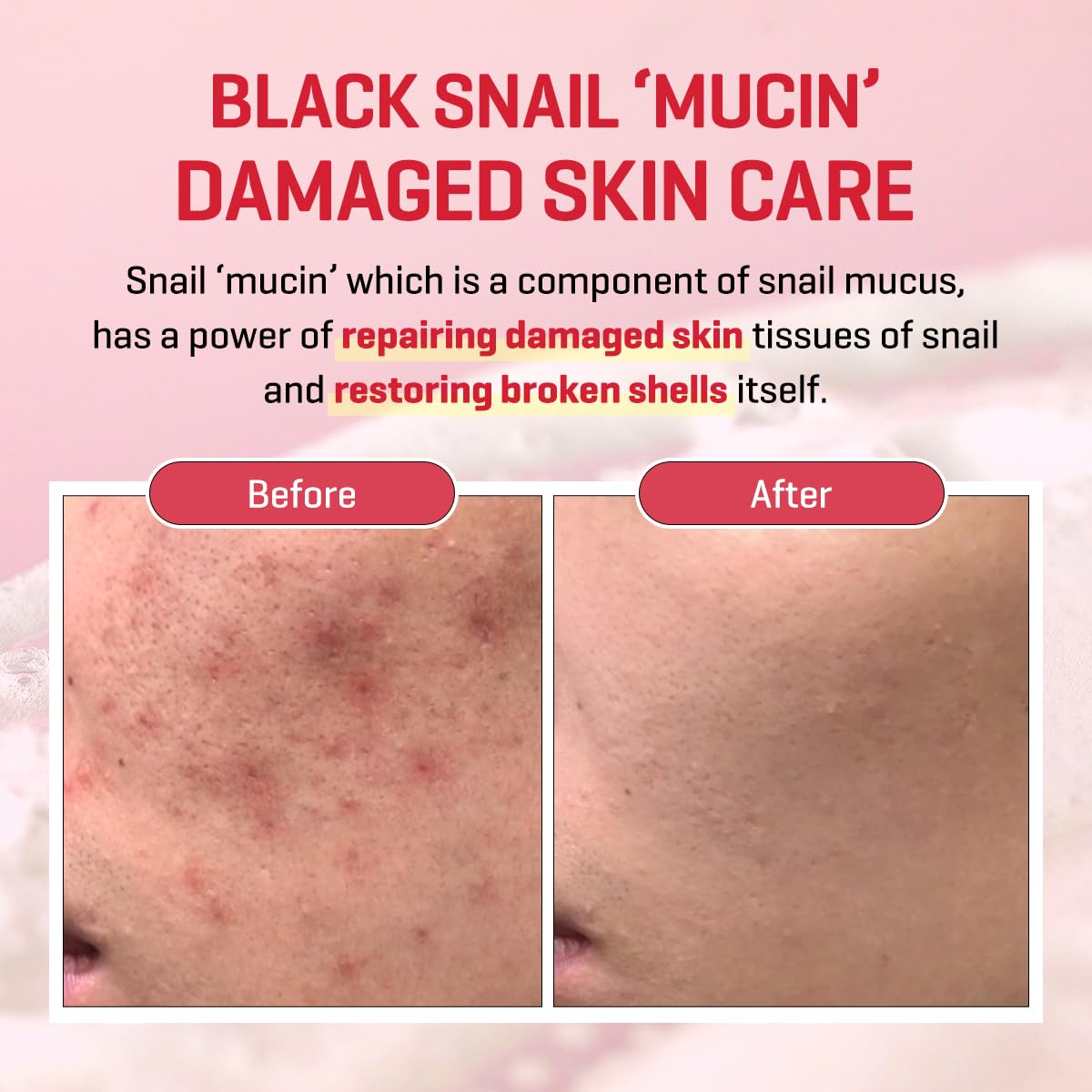 SOME BY MI - Snail Truecica Miracle Repair Serum