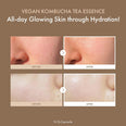 Dr. Ceuracle Vegan Kombucha Tea Essence