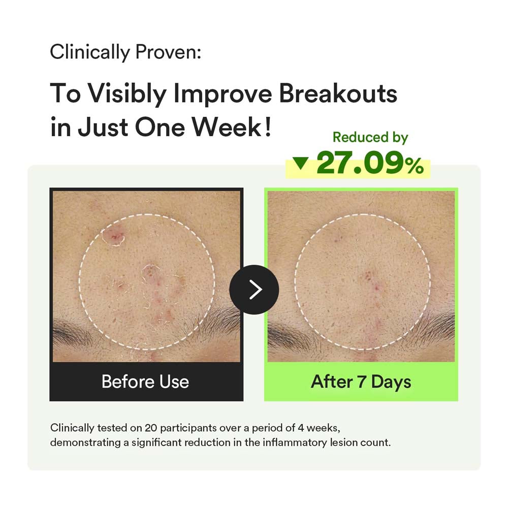 Abib Heartleaf TECA Capsule Serum Calming Drop