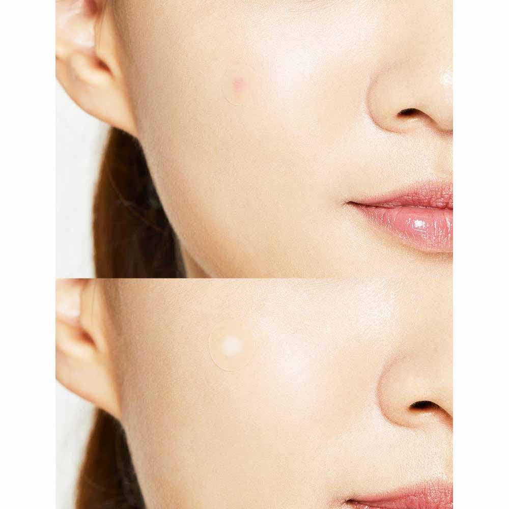 COSRX Acne Pimple Master Patch (24 pcs)