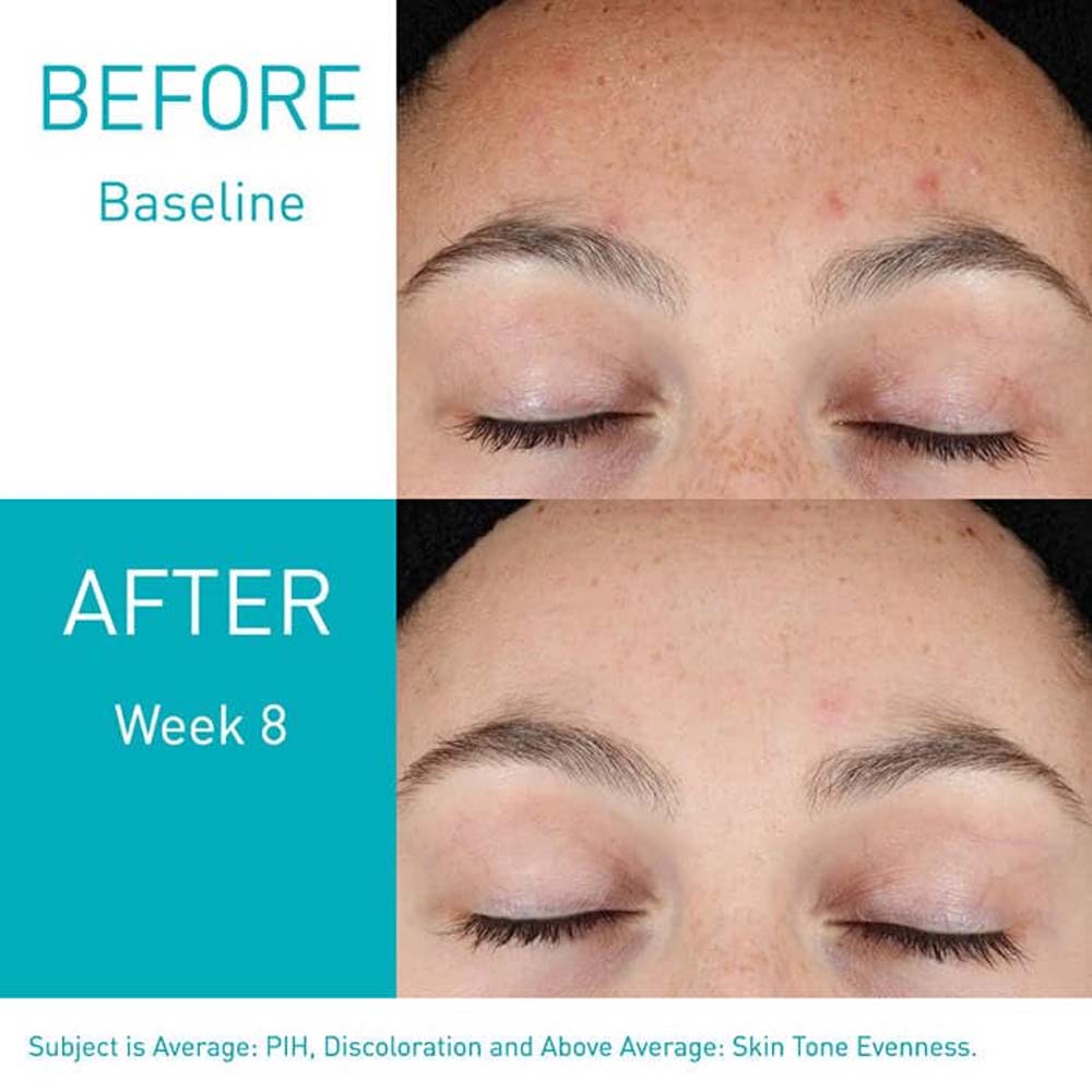 CeraVe Resurfacing Retinol Serum