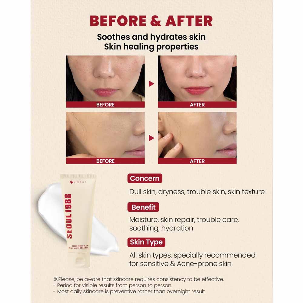 K-SECRET SEOUL 1988 Cream : Snail Mucin 93+Rice 100ml