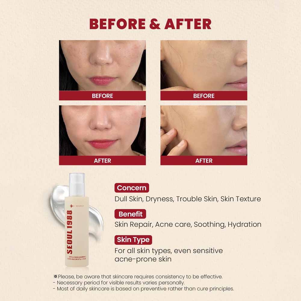 K-SECRET SEOUL 1988 Essence : Snail Mucin 97% + Rice 100ml