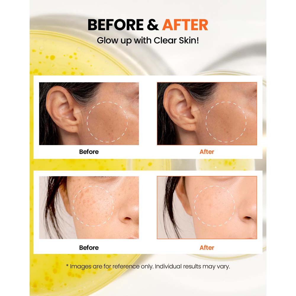 K-SECRET SEOUL 1988 Glow Serum: Niacinamide 15% + Yuja