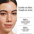 Neutrogena Oil-Free Acne Wash with 2% Salicylic Acid USA