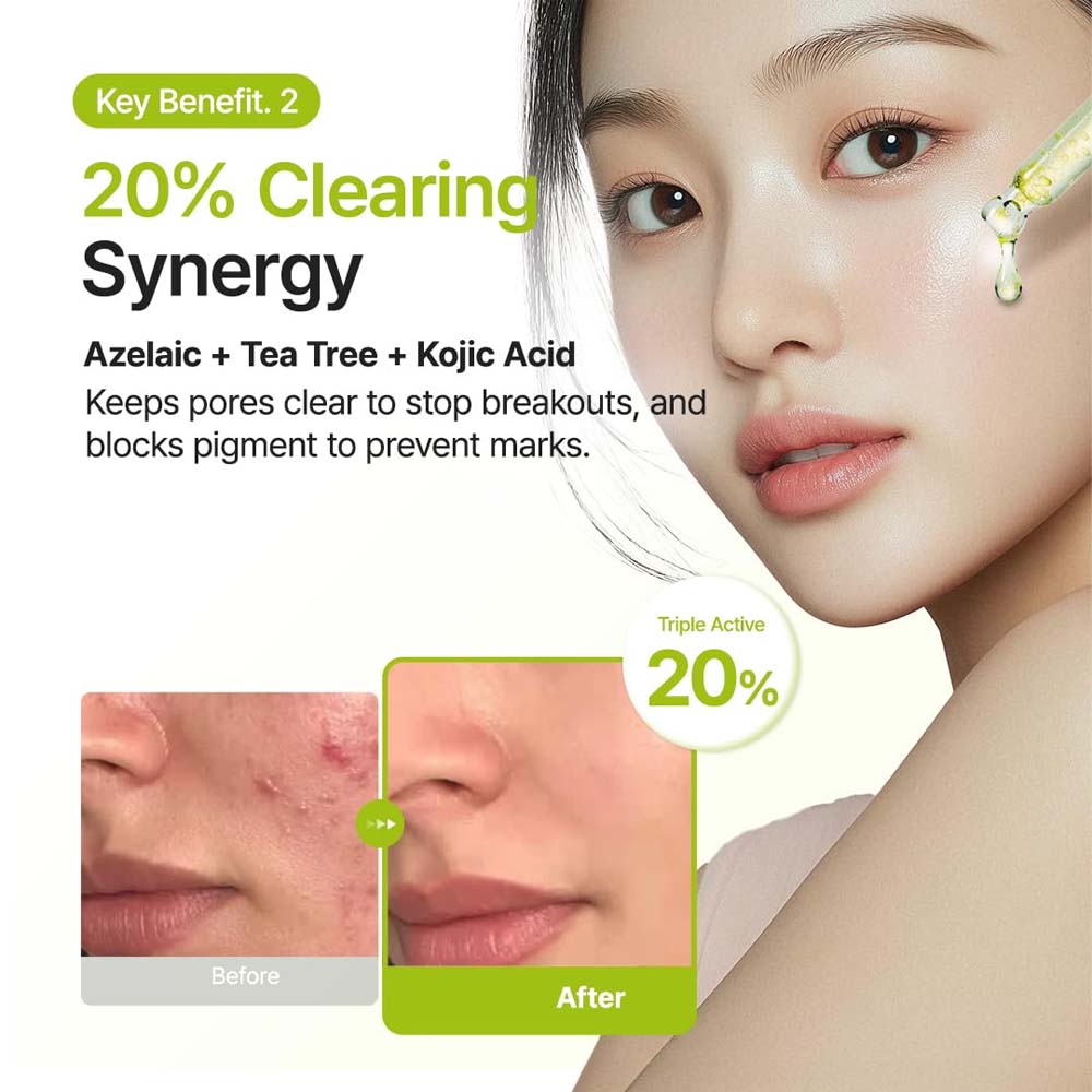 Purito SEOUL - Azelaic Acid 10 Kojic Tea Tree Serum