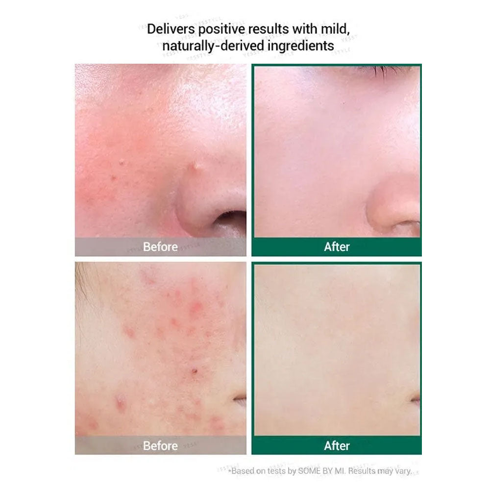 SOME BY MI AHA BHA PHA 30 Days Miracle Serum