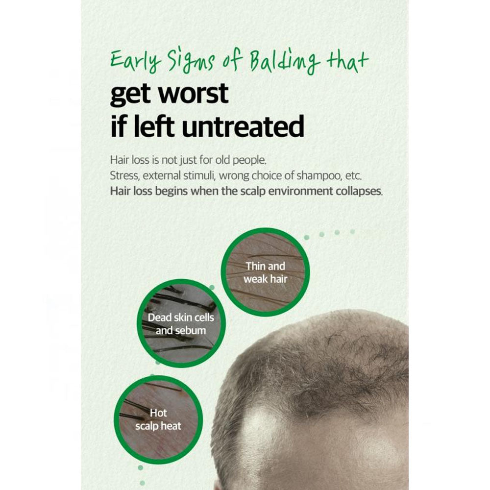 SOME BY MI Cica Peptide Anti Hair Loss Derma Scalp Tonic