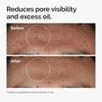 The Ordinary - Niacinamide 10% + Zinc 1% Serum
